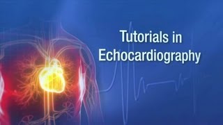 Echo Tutorials  Mayo Clinic [upl. by Aiak]