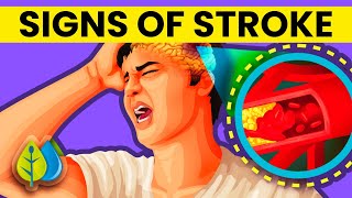 Spot these 10 Warning Signs of a Stroke One Week Before [upl. by Lockhart778]