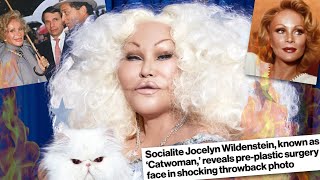 Jocelyn Wildenstein The Woman Who Became a Cat for Her Husband’s Bizarre OBSESSION [upl. by Riesman]