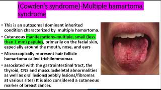 Squamous cell papilloma EVERYTHING you need to knowEtiologyclinical features histopath treatment [upl. by Wichern]