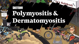 Path Study Guide Polymyositis amp Dermatomyositis  Sketchy Medical  USMLE Step 1 [upl. by Gershon]