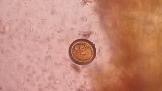 Egg of tapeworm or Taenia under the Microscope of saline preparation [upl. by Yenetruoc]