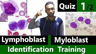 Myeloblast Vs Lymphoblast Identification Training Quiz 12 [upl. by Watkin]