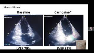 How Carnosine Benefits the Heart [upl. by Navlys]