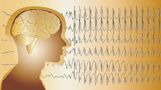 ONDES THÊTA 10h Pour Relaxation Profonde Mémoire amp Dormir [upl. by Helali505]