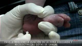 Forma Correcta de Recolectar la Muestra para el Tamiz Neonatal [upl. by Sibie599]