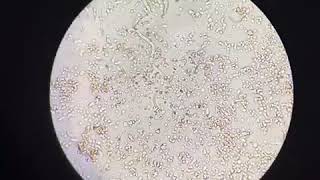 Microfilaria wet film exam [upl. by Nymassej]