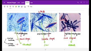 Superficial Mycoses  Microbiology fungal infections Image based discussion [upl. by Ecnerolf380]