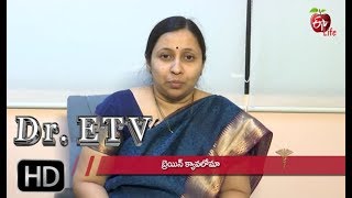 Brain Cavernoma  Dr ETV  6th April 2019  డాక్టర్ ఈటీవీ [upl. by Attirehs930]