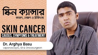 ত্বক ক্যান্সার কারন লক্ষন এবং চিকিৎসা  Skin Cancer Causes symptoms types amp Treatment in Bangla [upl. by Nauquf]