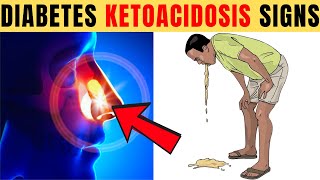 8 Fatal Diabetic Ketoacidosis Symptoms Most Diabetics Ignore [upl. by Reube]