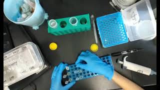 Plasmid Extraction from Ecoli Bacteria [upl. by Kenzi]