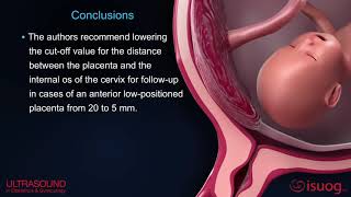 New UOG video abstract on placenta previa and low‐lying placenta second trimester ultrasound [upl. by Castillo]