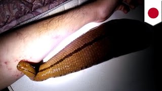 Giant pet leech Owner gives parasitic pet its daily dose of blood straight from his arm [upl. by Emmalyn]