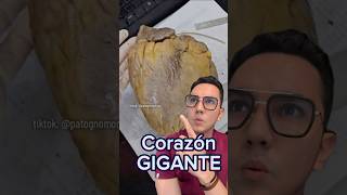 Cardiomegalia corazón grande débil y perezoso  Dr William Guerrero medicina shorts [upl. by Oslec]