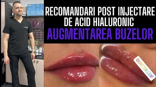 RECOMANDARI post injectare de ACID HIALURONIC  AUGMENTAREA BUZELOR [upl. by Willing474]