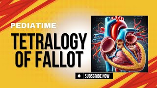 Tetralogy of Fallot  Congenital Heart Diseases  Pediatrics  Pediatime [upl. by Jezebel]