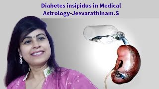 Diabetes insipidus in Medical Astrology [upl. by Aylatan]