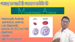 Megaloblastic Anemia medicalentranceexam neetcutoffformedicalcollege preparation pathology [upl. by Marta]