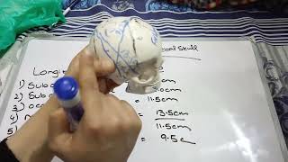 Diameter of fetal skull [upl. by Htiekal]