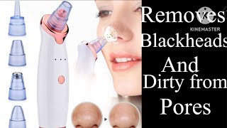 Creative vlogRemoves Blackheads And Dirty from poreselectric toolBlackhead removed tool [upl. by Hartzke]