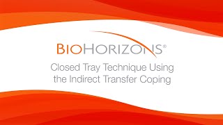 Closed Tray Technique Using the Indirect Transfer Coping [upl. by Naget]