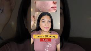 😱 Instant Glowing Skin Challenge ❤️🎀glowingskin skinbrightening glowup simranskincare [upl. by Hersch]