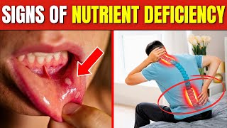 10 Hidden Signs Of Nutrient Deficiency You Should Never Ignore [upl. by Anaeed675]