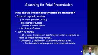 Ultrasound for Fetal Presentation  Lecture [upl. by Akinert352]