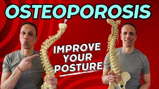 Osteoporosis How to Fix Your Back HumpKyphosis [upl. by Bern]