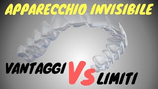 Apparecchio invisibile vantaggi e limiti [upl. by Hatty]