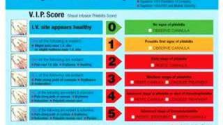 VIP score discussion from Andrew Jackson [upl. by Victorie]