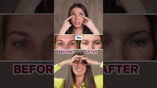 HOW TO REMOVE UNDEREYE BAGS LINK IN BIO [upl. by Feinleib655]