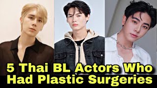 Top 5 Thai BL Actors Who Had Plastic Suregry  Thai bl  bl 2024 [upl. by Tandie931]