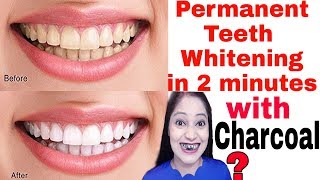 Permanent Teeth Whitening remedy at homeहमेशा के लिये दातो को सफेद बनाए NaturallyBe Natural [upl. by Pacifica]