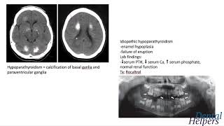 Systemic Diseases [upl. by Einad]