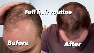 The Hair routine that saved my hair… Reversing hair loss EP 2 [upl. by Nauhs286]