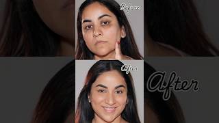 NO Foundation amp Concealer How to Cover Dark Circles Spots amp Scars [upl. by Yesrod]