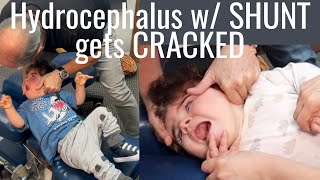 Dangerous Neck Adjustment on 1 year old by Chiropractic Specialist Dr Ace  Part 23 [upl. by Tadeo628]