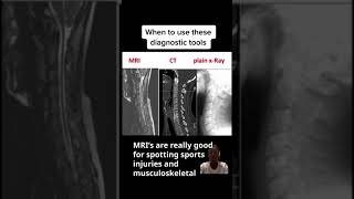 MRI CT amp xray scans  When to use what  Lecturio [upl. by Nnayd]