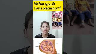 meri kis type ki twins pregnancy thi dichorionic diamniotic twins pregnancy ka kya matlab hota hai [upl. by Nnaeirrac]