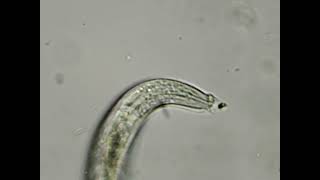 nematode eating a bacteria [upl. by Golding110]