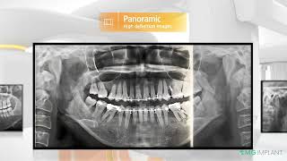 Rayscan Alpha plus CBCT [upl. by Albie704]