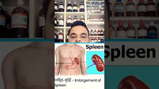 Enlargement of spleenSplenomegalyhomeopathyshortsDr Deepak singh prayagraj [upl. by Rojas]