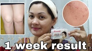 BEAUCHE GLUTA SOAP1 WEEK TRIAL 45 PESOS ONLYhonest review [upl. by Recha]