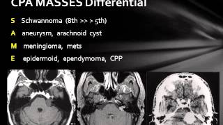 Cerebellopontine Angle Lesions [upl. by Delija]