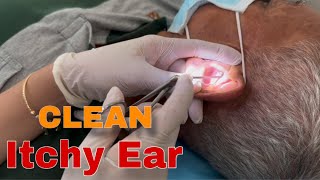 Clean for Itchy Ears  Doctor Anh [upl. by Okiam]