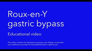 Bariatric roux en y gastric bypass educational video [upl. by Nnil]