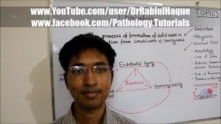 Thrombosis  Definition Pathogenesis Morphology amp Fate HD [upl. by Craddock]