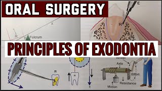 PRINCIPLES OF EXODONTIA II TOOTH EXTRACTION II ORAL SURGERY II imp [upl. by Aymahs526]